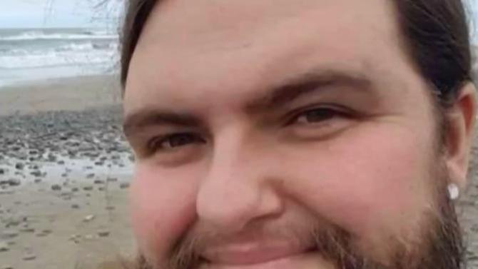 十位地球上百万分之一的罕见人类！