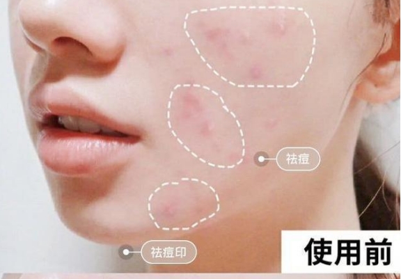 面霜 “国货之光”面霜推荐:超好用的国产面霜,平价好用还很补水保湿,明星都在用