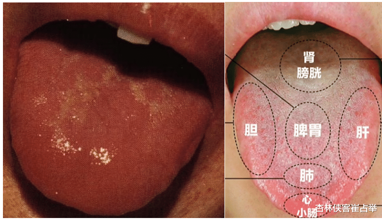 新型冠状肺炎|体质弱、抵抗力差易生病，中医教你一招，让你提高免疫力！