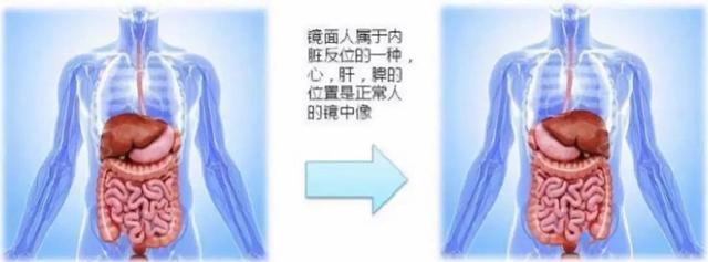 左撇子比右撇子更聪明?这到底是不是真的?真相比你想的复杂的多