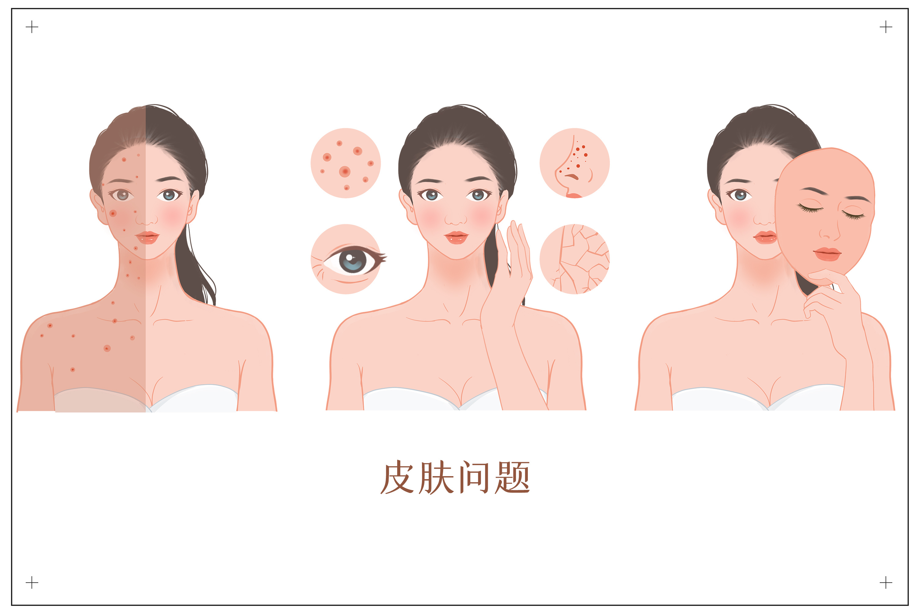 护肤 草木护肤 | 敏感肌护肤的六个小锦囊