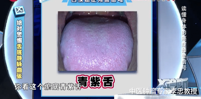 肿瘤|“只看了一眼，就说肝功有问题！” 中医通过?望?真的能判断病情？