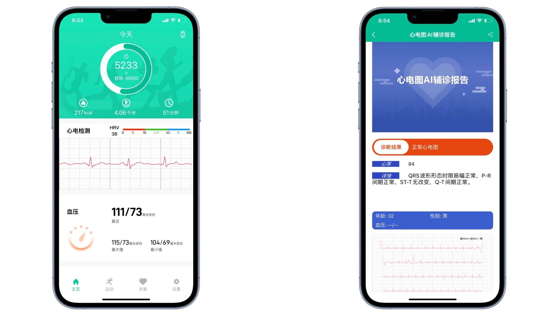 Google|这块手表够智能，健康监测确实牛—dido E10心电血压智能手表