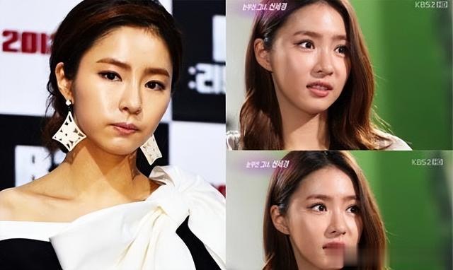 整容|宋慧乔颜值垮掉了？脸部肿胀，僵硬嘴歪，疑似整容后状态不佳