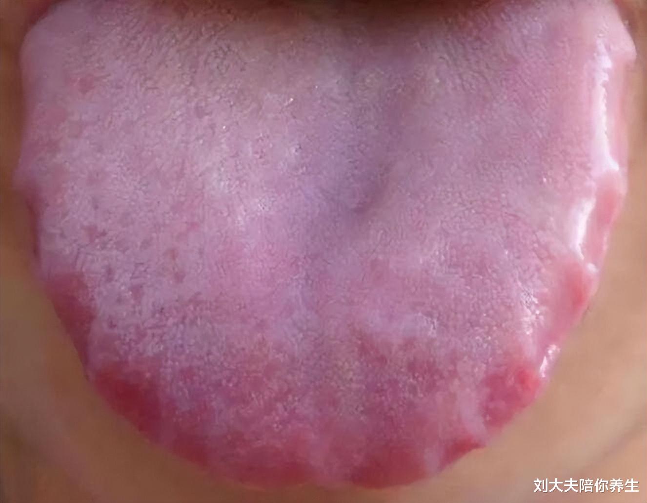 脾胃虚寒|吃得少还胀气，舌边有齿痕？脾胃虚寒，2个经典食疗方助你改善