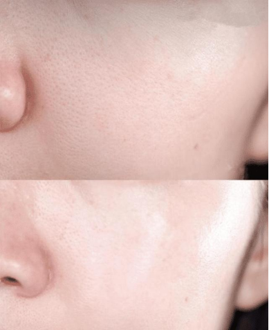 护肤 李小冉“护肤秘诀”火了，轻松养成光滑婴儿肌，金晨：我都用2年了