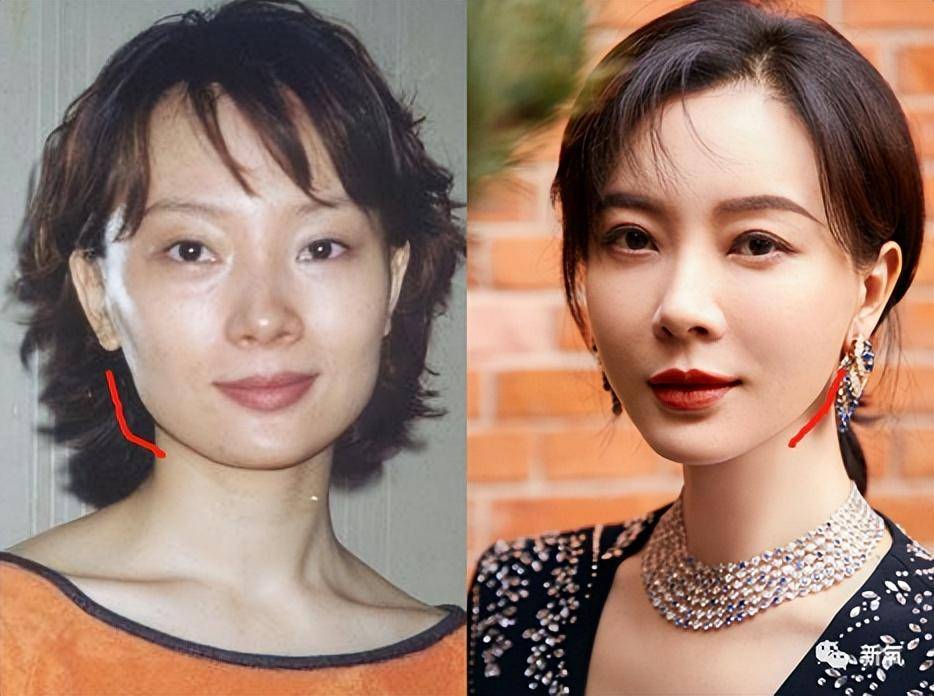 整容|表面“美若天仙”，实则“又土又丑”的8位女星，个个整得太惊艳