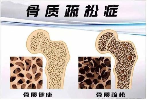 饮食 男性160-188cm标准体重对照表，对照下，或许你并不胖，无需减肥