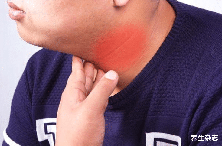 甲亢|多家医院联合呼吁：脖子变粗，未必是甲亢，或是甲状腺癌预警，及时检查