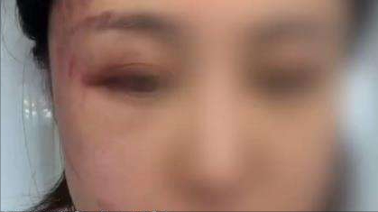 徐大宝|娱乐圈家暴到底多严重？女星举报丈夫家暴，男方称家中发现避孕套