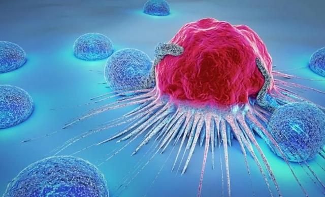 癌细胞|检查上写的“原位癌”是啥意思？原位癌有哪些危害，一文讲清