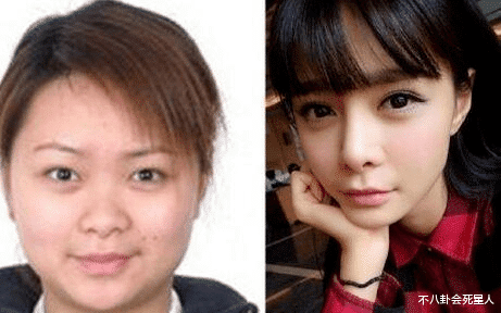 金赛纶|女星整容一直在路上：沈梦辰近照不敢认，杨子姗换个角度就变脸