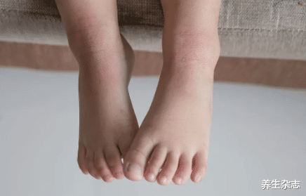 养生|再三提醒:不论男女,晨起出现4种异常,多半是肾衰,尽早就医