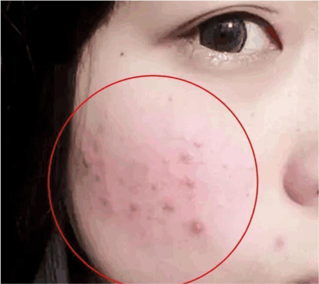 霍思燕 活在“美颜”里的你,底妆是否真的干净?其实关掉美颜后,妆容“尴尬”到影响颜值