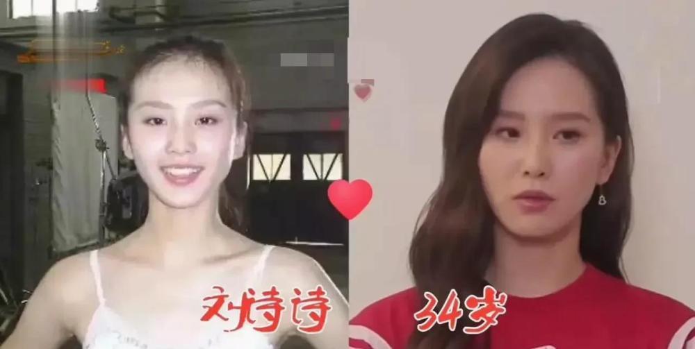 刘亦菲|打死不整容的明星今昔,周慧敏颜值一直在线,看到朱茵:一眼沦陷