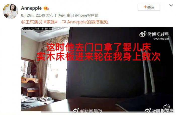 又一演员被曝家暴,晒验伤照片证明自己所言非虚