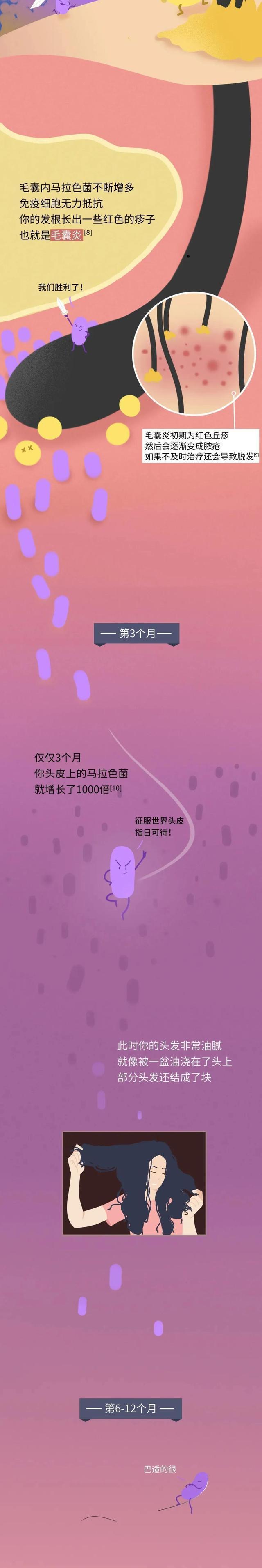 女孩 一年“不洗头”，头皮会发生哪些变化？爱美的女孩要注意