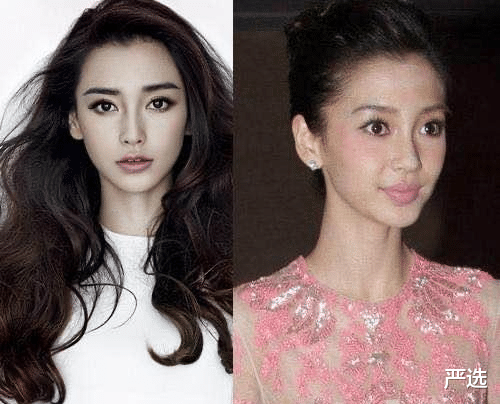 蒜蓉西兰花 那些经常做医美的人，皮肤真的变好了吗？王鸥：后悔都晚了