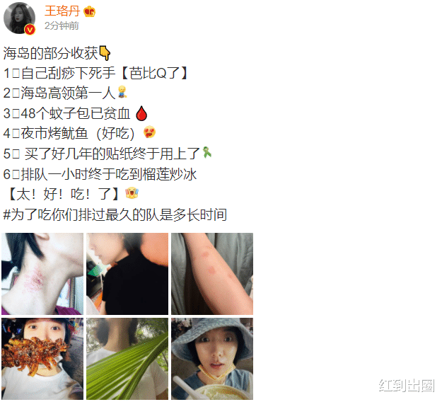 王珞丹|38岁王珞丹独自到海岛游玩,被蚊子咬一腿包,为脖子刮痧太吓人