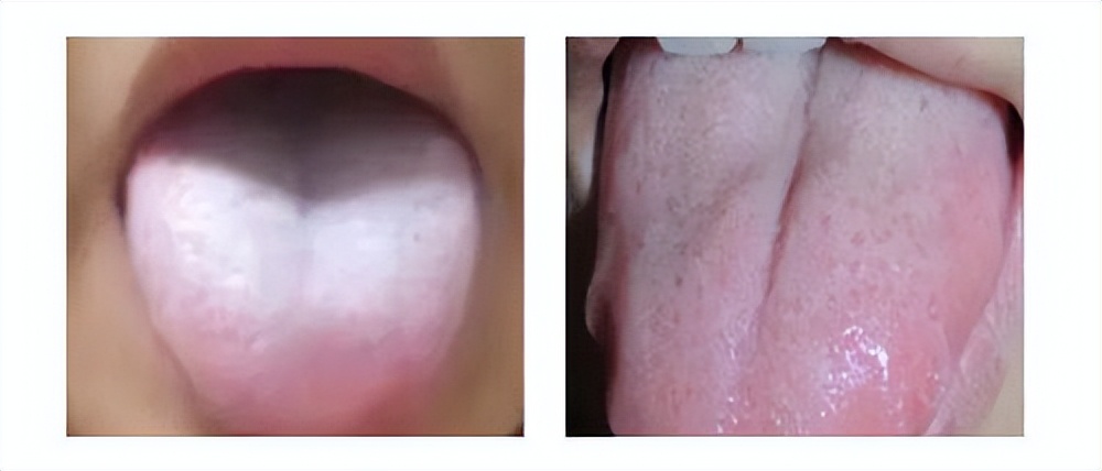 更年期|腰疼别大意!可能是因为这5个原因,学会不走弯路