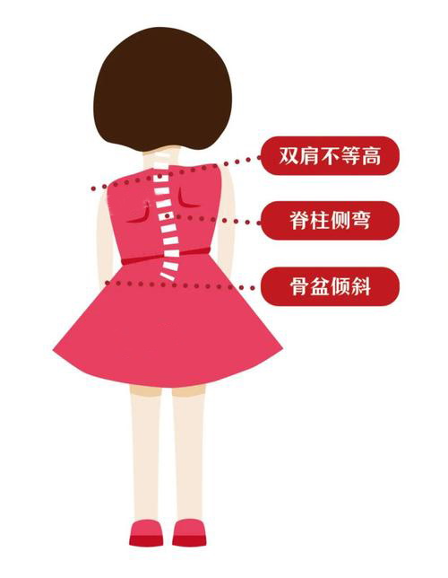 胃黏膜|脊柱侧弯在哪个年龄阶段进展较快?