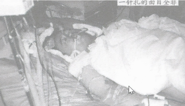 广西女护士给同事注射不明液体致其死亡,笑称:开个玩笑而已