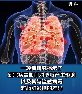 新冠病毒或对心脏DNA产生影响