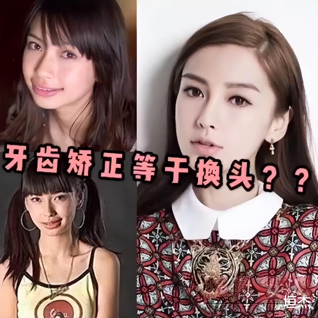 明星|女明星“假牙”大PK，谁的嘴巴闭不上，谁的嘴里藏着一套房？