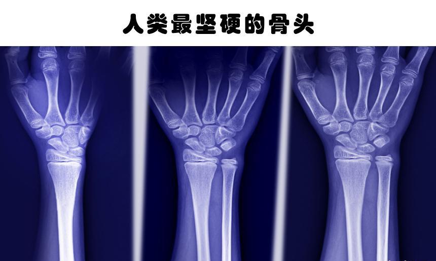 超级强大的力量?坚硬的骨骼?这7种独特的身体特征仅少数人拥有