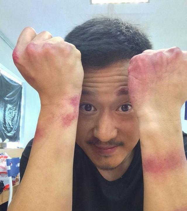 娱乐圈|赵丽颖的血栓，吴京的长短腿，娱乐圈没有哪个巨星，可以随便成功