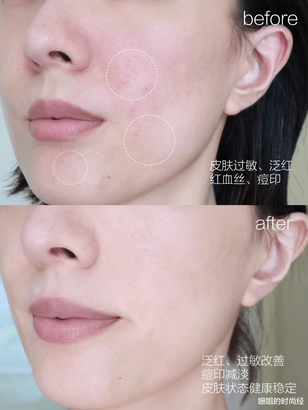 水煮蛋 50+的女人用什么精华液好？这5款好用的“抗皱精华”，值得入手