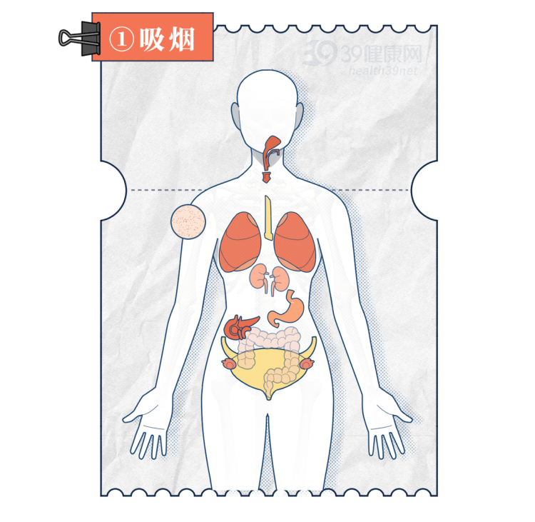 |癌症与饮食息息相关!提醒:7种食物或是癌细胞最爱,要管住嘴