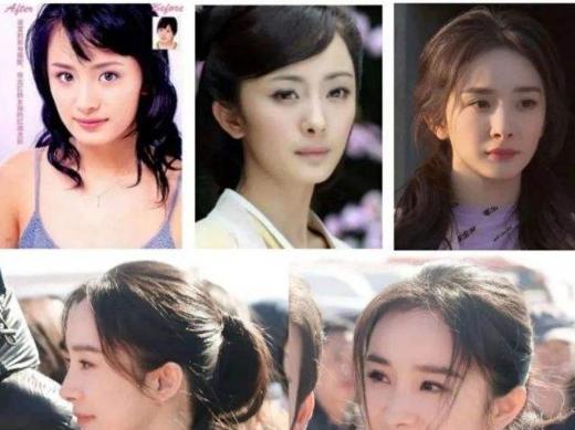 杨幂|从“大饼脸变成小V脸”的9位明星，杨幂说整了牙，金晨死鸭子嘴硬