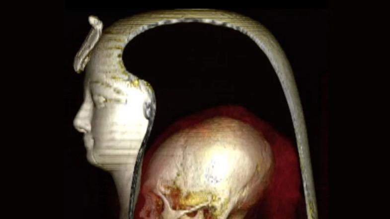 一位木乃伊专家说，古埃及人从鼻子里取出木乃伊的大脑