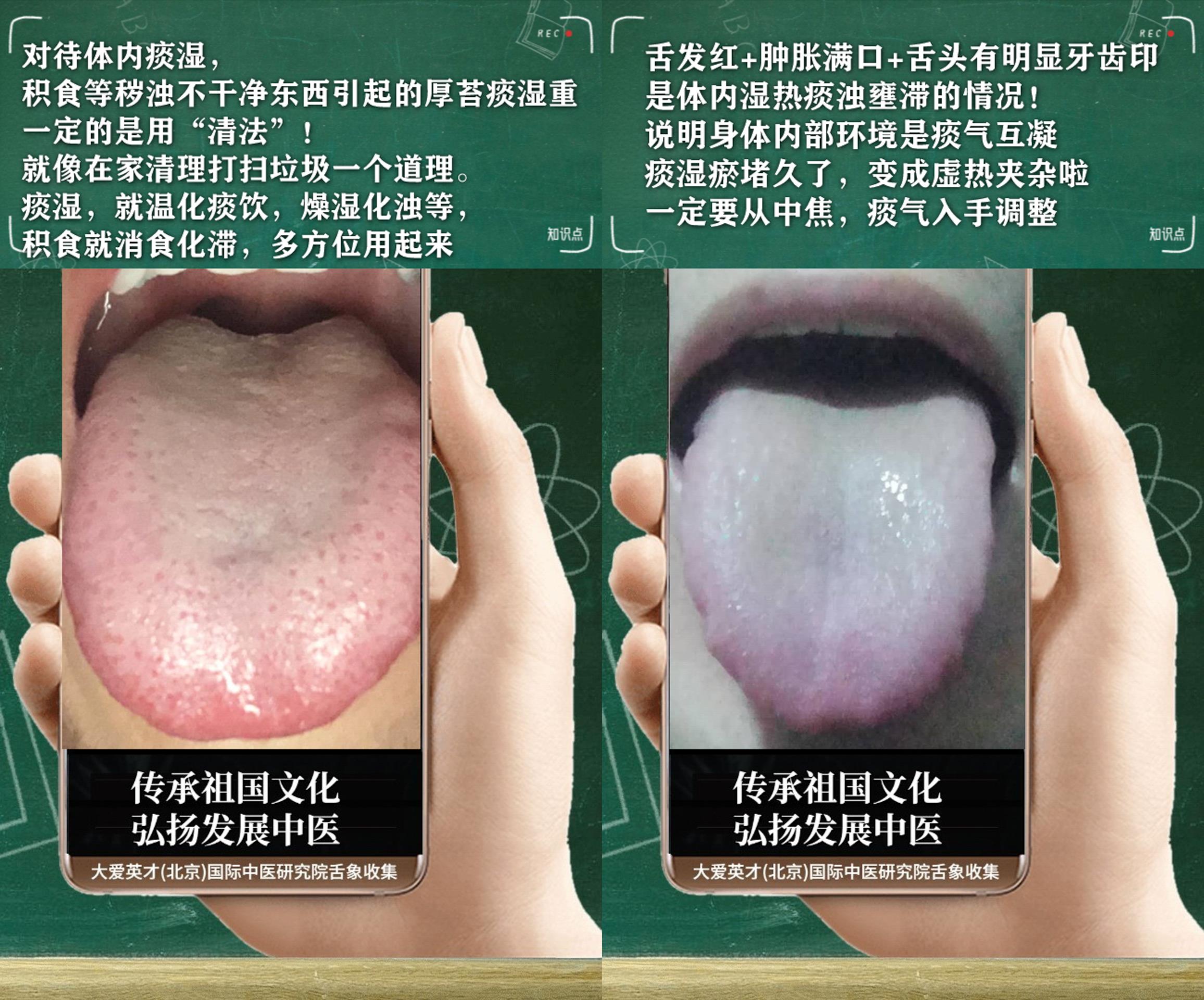 |中医解剖：常内心不安，容易出汗，鼻涕胶黏，时好时坏很难过