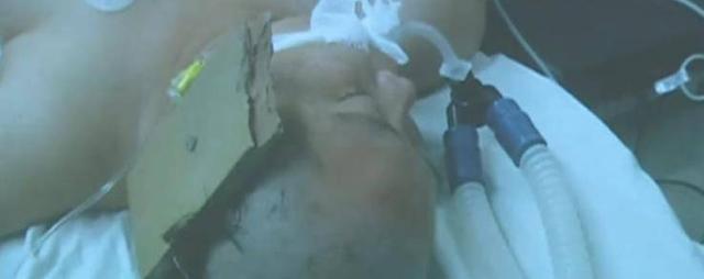 07年小舅子触电身亡,2年后铁钉扎入妻子头颅,丈夫被判死刑