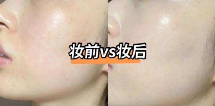 护肤品 孕期也能保持少女感!公认好用的孕期化妆品大盘点,人气高口碑好