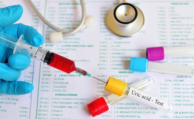 尿酸|这些“排酸高手”就藏在厨房,经常吃点,尿酸不升高,痛风不靠近