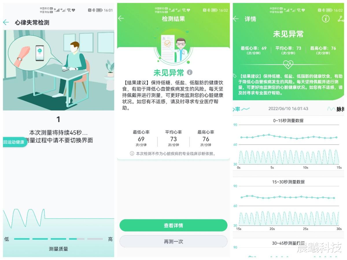 小米手环|618手环购买攻略，200多到底该买哪款？