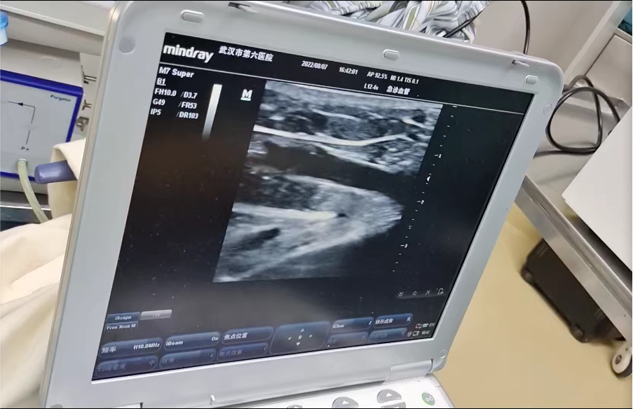 |反复溃烂,久治不愈,很多老烂腿患者一直在做无用功?老烂腿反复怎么办