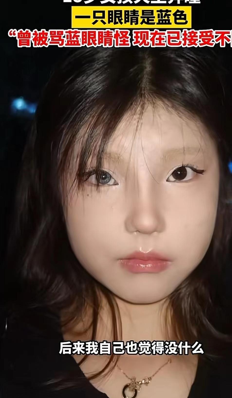 女孩天生异瞳,怪物?美人坯子