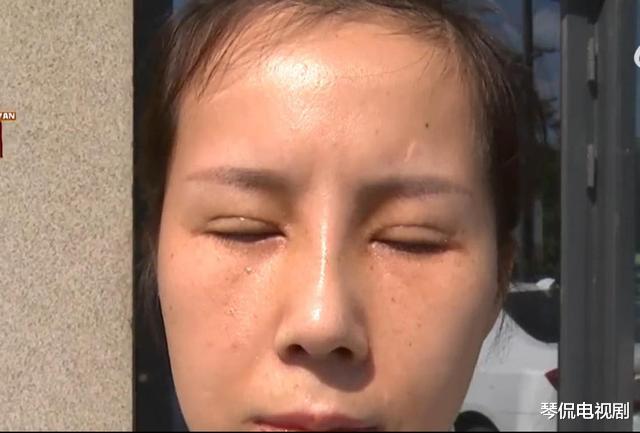 ?女子整容后,朋友:花钱找罪受!整形医院:恢复期未到!