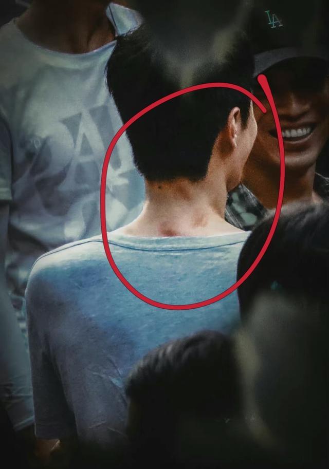 王一博|王一博拍戏“浑身是伤”！脖子后面淤青，不怕疼改革群演打闹