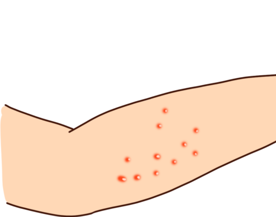 过敏|皮防科普丨人体过敏源，为了你的健康请先进行自查