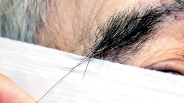 心脏|无论男女,这里“毛”越多,可能越长寿!可惜多数人都刮掉了