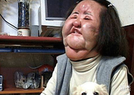 整容|7位“整容塌房”的女星，不说名字，你还能认出来吗？