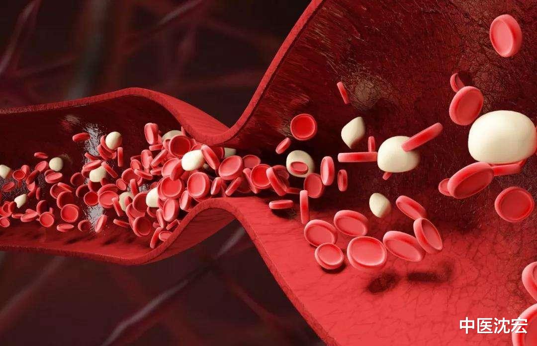 中成药|瘀血一通，浑身轻松，一个中成药，活血化瘀，通心、通脑、通血管