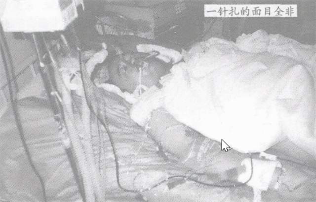 广西女护士给医生注射毒针,致其毒发身亡后,护士:我开了个玩笑