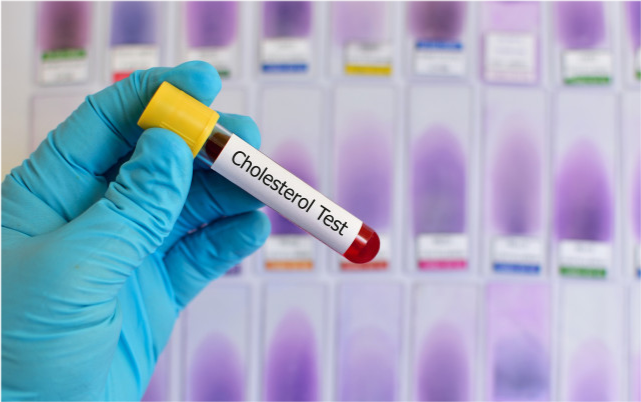 高血脂|查出血脂超标后，这6种“素食”要尽量少吃，望你早做了解