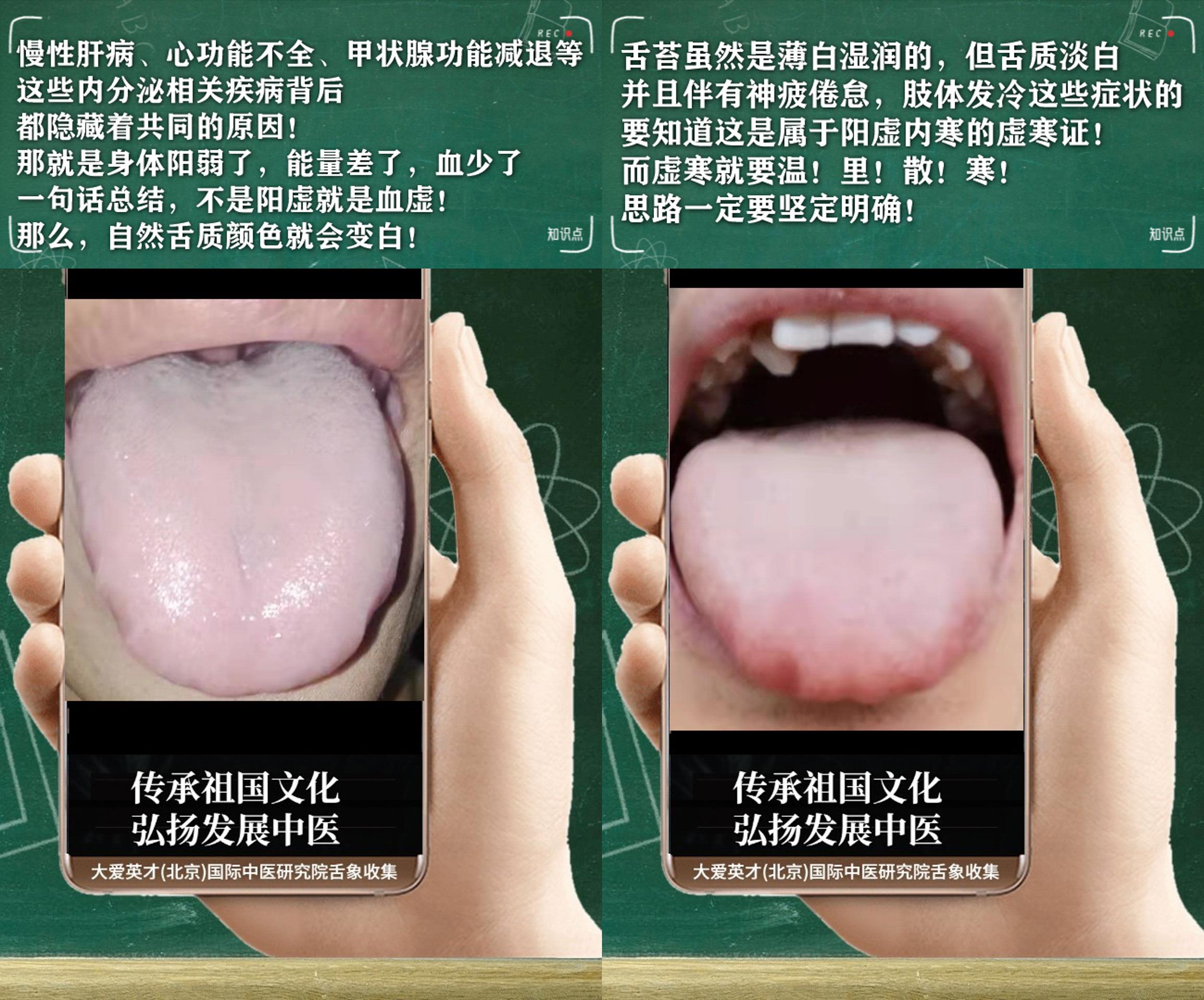 中成药|中医病症：自责、情绪低落、鼻咽干涩、一直未愈很难过